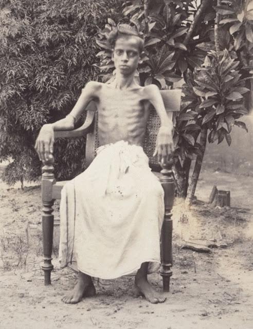 A Patient - Kerala 1901